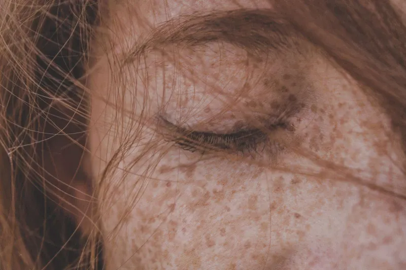 Let's Find Out Best Makeup To Cover Melasma On Upper Lip Right Now! 1 Best Makeup To Cover Melasma On Upper Lip