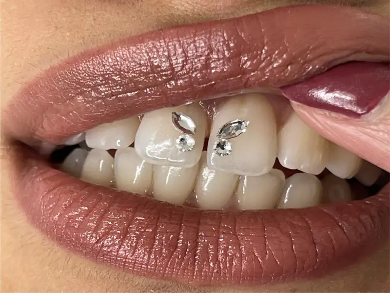 tooth jewels kit